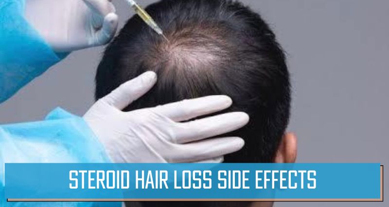 Steroid Hair Loss Side Effects