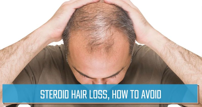 Steroid hair loss, how to avoid