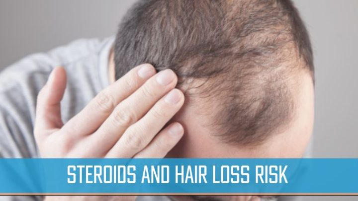 Steroids and Hair Loss Risk